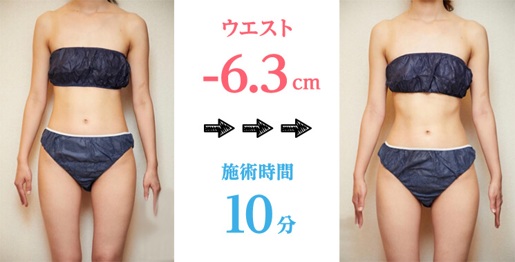 ウエスト-6.3cm、施術時間10分